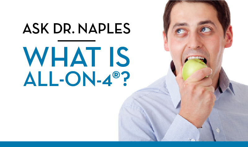 Ask Dr. Naples What Is All On 4